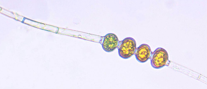 Unbekannt_-_Bild_067_-_Oedogonium_mit_Zygoten__Foto_Guenther_Dorn