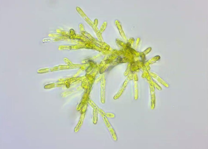 Unbekannt_-_Bild_068b_-_115my__vermutlich_Microthamnion__Foto_Guenther_Dorn