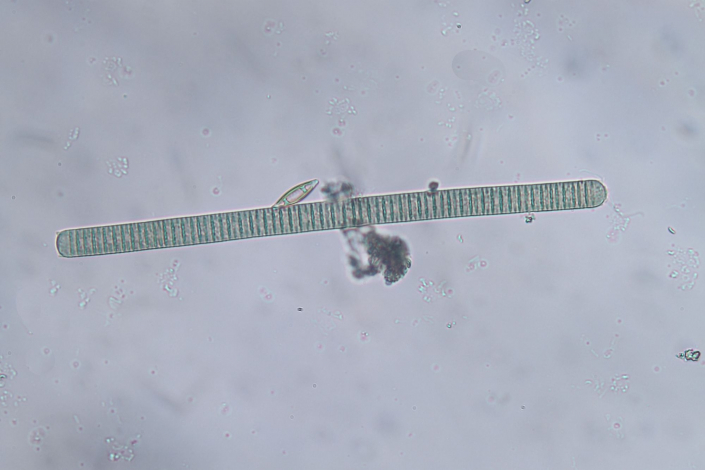 Aileswasensee-Maerz-2026__Oscillatoria _limosa_x__Foto_Horst_Fries