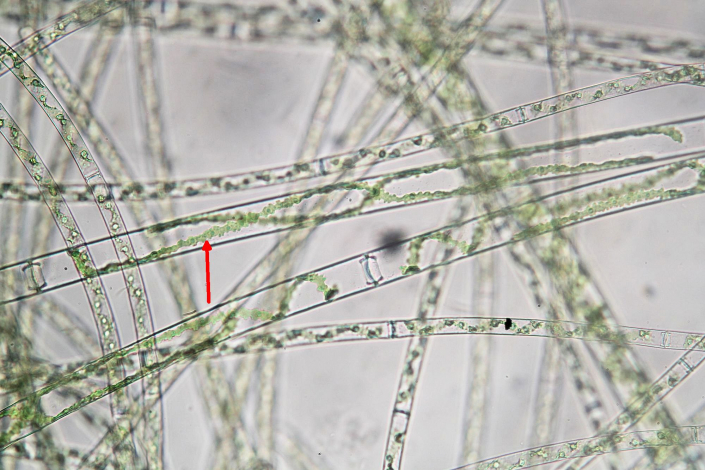 Aileswasensee-Maerz-2026__Spirogyra_mit_sehr_langen_Windungen__Foto_Horst_Fries