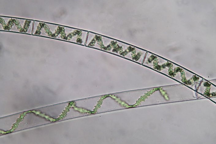 Aileswasensee-Maerz-2026__Spirogyra_mit_unterschiedlich_langen_Windungen__Foto_Horst_Fries