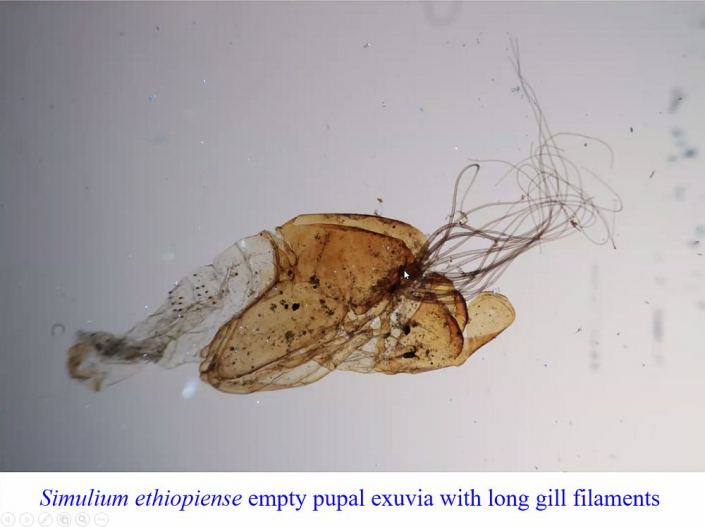 Flussblindheit-Bekaempfung_in_Aethioien__Bericht_Alfons_Renz_35