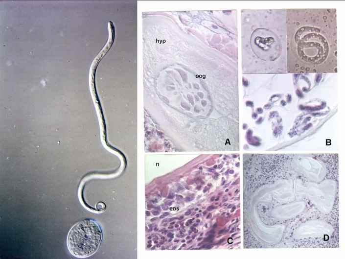 Onchocerca__Beitrag_Alfons_Renz_5