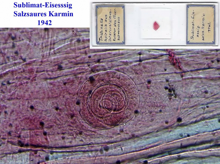 Trichinen_und_Trichinen-Mikroskope_1