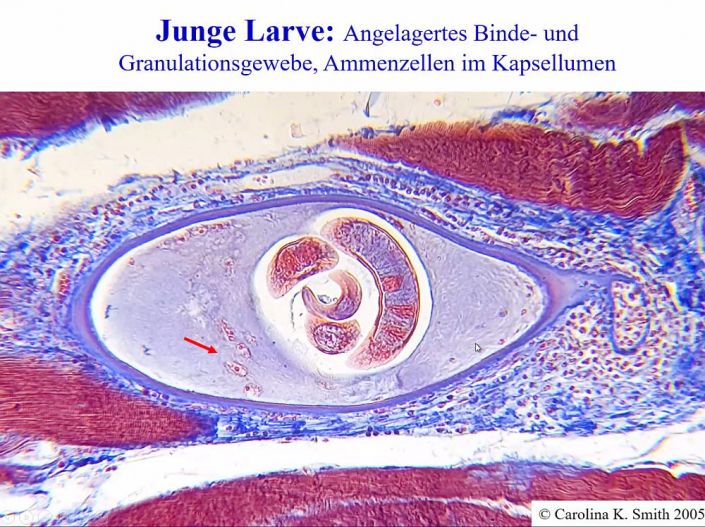 Trichinen_und_Trichinen-Mikroskope_2