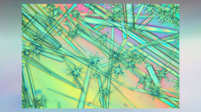 Meine_neu_erworbenen_Praeparate_-_Kalkkoerper__Foto_Igor_Reicher_02