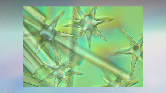 Meine_neu_erworbenen_Praeparate_-_Kalkkoerper__Foto_Igor_Reicher_03