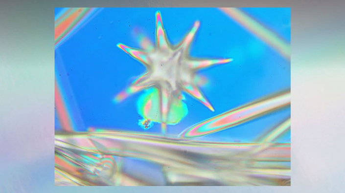 Meine_neu_erworbenen_Praeparate_-_Kalkkoerper__Foto_Igor_Reicher_04