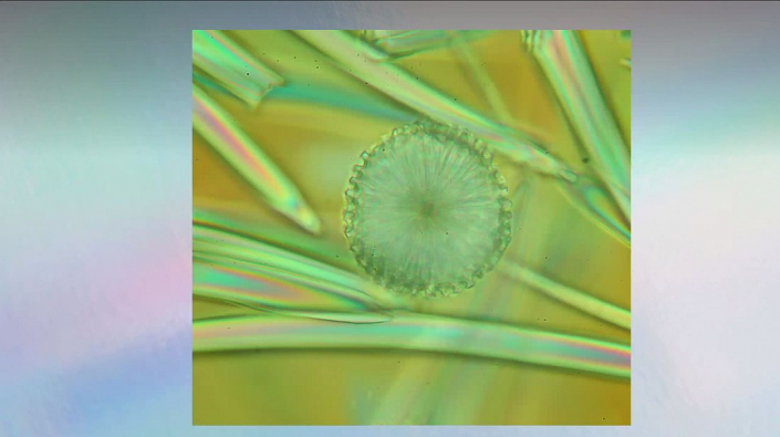 Meine_neu_erworbenen_Praeparate_-_Kalkkoerper__Foto_Igor_Reicher_05