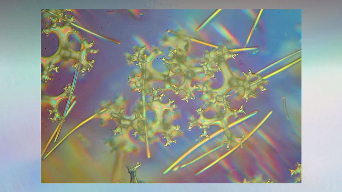 Meine_neu_erworbenen_Praeparate_-_Kalkkoerper__Foto_Igor_Reicher_06