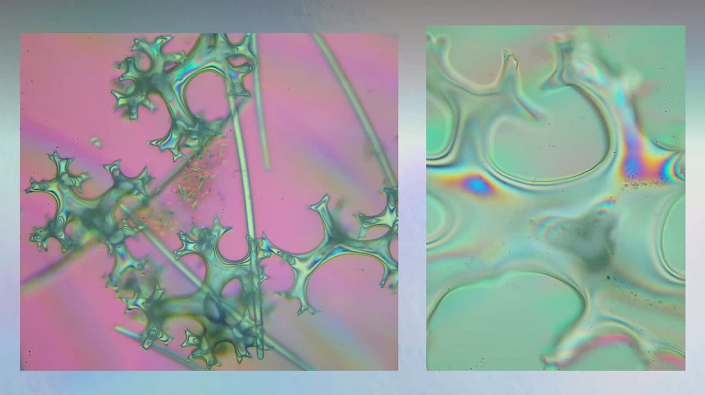 Meine_neu_erworbenen_Praeparate_-_Kalkkoerper__Foto_Igor_Reicher_07