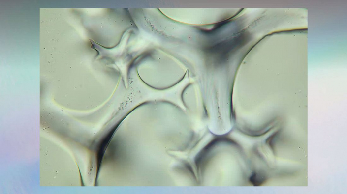 Meine_neu_erworbenen_Praeparate_-_Kalkkoerper__Foto_Igor_Reicher_08