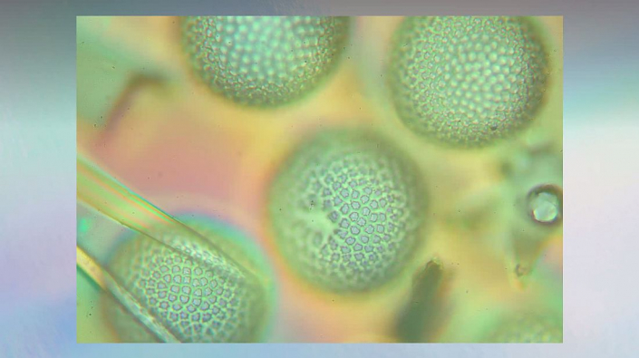 Meine_neu_erworbenen_Praeparate_-_Kalkkoerper__Foto_Igor_Reicher_09