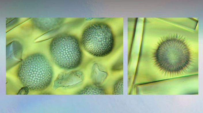 Meine_neu_erworbenen_Praeparate_-_Kalkkoerper__Foto_Igor_Reicher_10