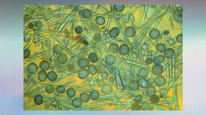 Meine_neu_erworbenen_Praeparate_-_Kalkkoerper__Foto_Igor_Reicher_11