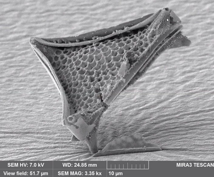 Diatomeen aus Flatonia Texas - Triceratum pantocsekii - REM (Beitrag Anne Gleich)