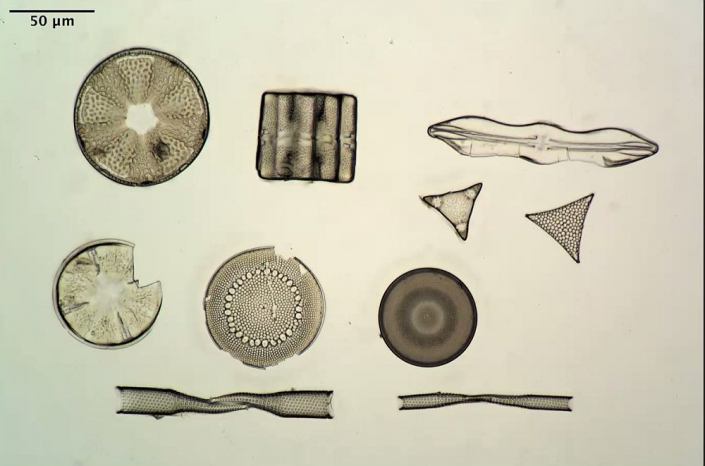 Texas-Diatomeen (Foto Anne Gleich)