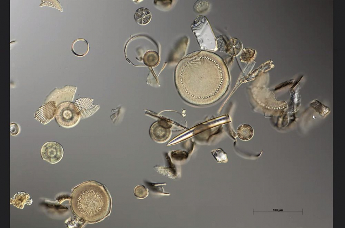 Texas-Diatomeen (Foto Anne Gleich)