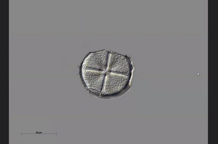 Texas-Diatomeen - Actinodytion weissflogi (Foto Anne Gleich)