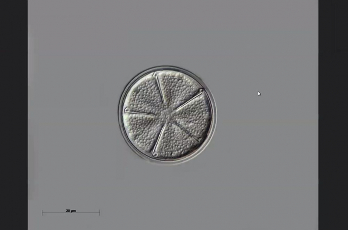 Texas-Diatomeen - Actinodytion weissflogii (Foto Anne Gleich)