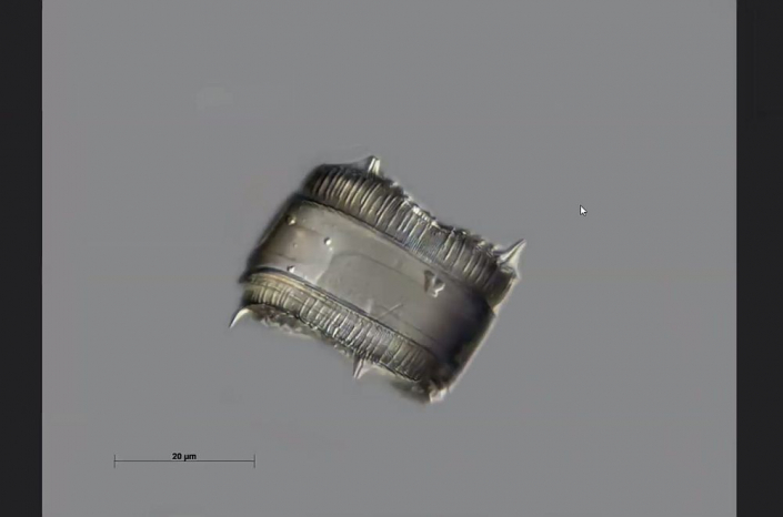 Texas-Diatomeen - Actinptychus - Gürtelansicht (Foto Anne Gleich)