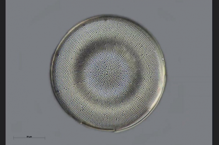 Texas-Diatomeen - Cestodiscus stokesianus (Foto Anne Gleich)