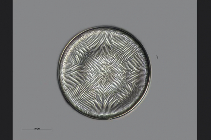 Texas-Diatomeen - Cestodiscus stokesianus (Foto Anne Gleich)