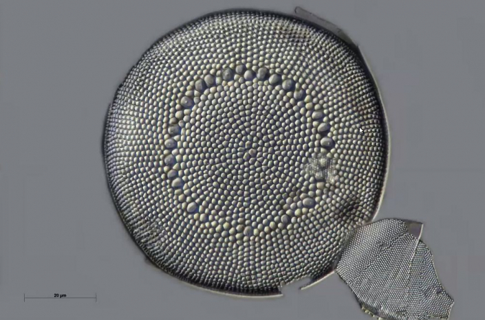 Texas-Diatomeen - Coscinodiscus bulliens (Foto Anne Gleich)