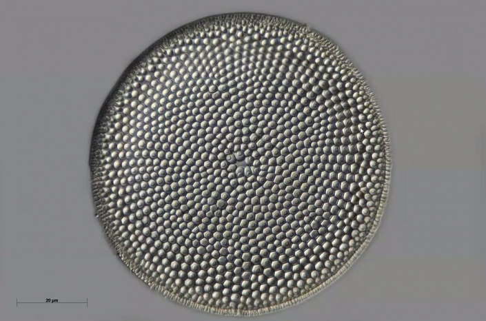 Texas-Diatomeen - Coscinodiscus (Foto Anne Gleich)