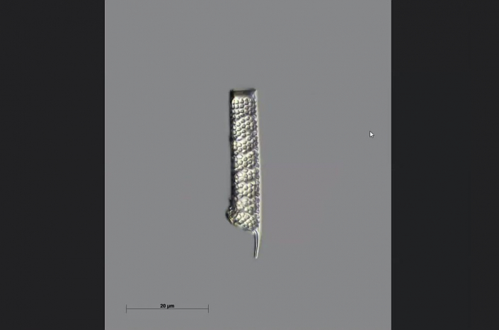 Texas-Diatomeen - Cylindrospina variablilis (Foto Anne Gleich)