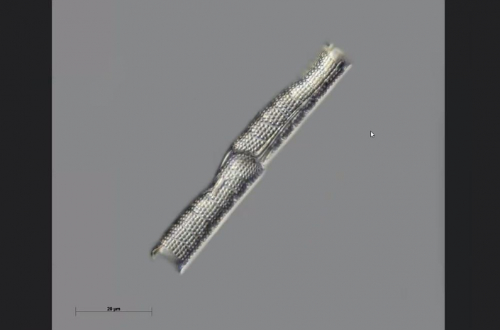 Texas-Diatomeen - Cylindrospina variablilis (Foto Anne Gleich)