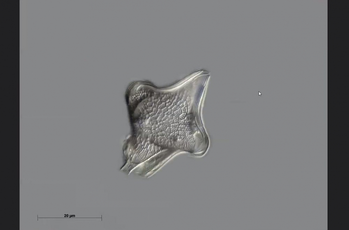 Texas-Diatomeen - Diommatetras (Foto Anne Gleich)