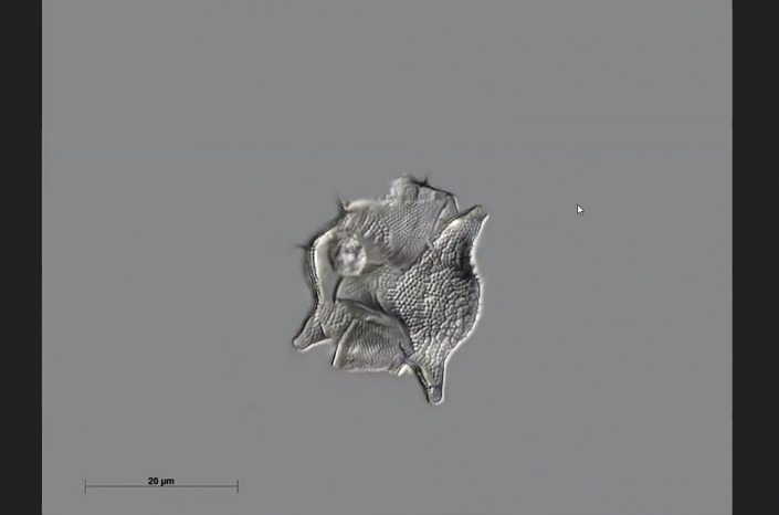 Texas-Diatomeen - Diommatetras (Foto Anne Gleich)