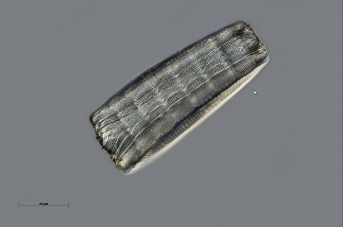 Texas-Diatomeen - Eunotia Gürtelbandansicht (Foto Anne Gleich)