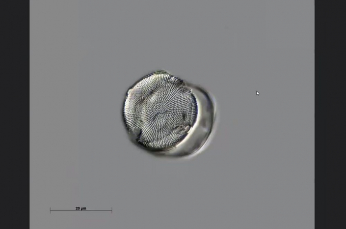 Texas-Diatomeen - vielleicht Eupodiscus (Foto Anne Gleich)
