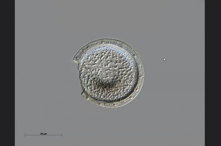 Texas-Diatomeen - Paralia flatoniana, initiale Valve (Foto Anne Gleich)