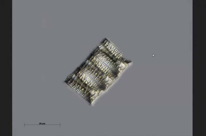 Texas-Diatomeen - Paralia flatoniana (Foto Anne Gleich)