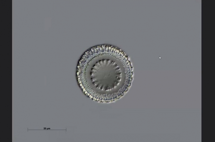 Texas-Diatomeen - Paralia flatoniana (Foto Anne Gleich)