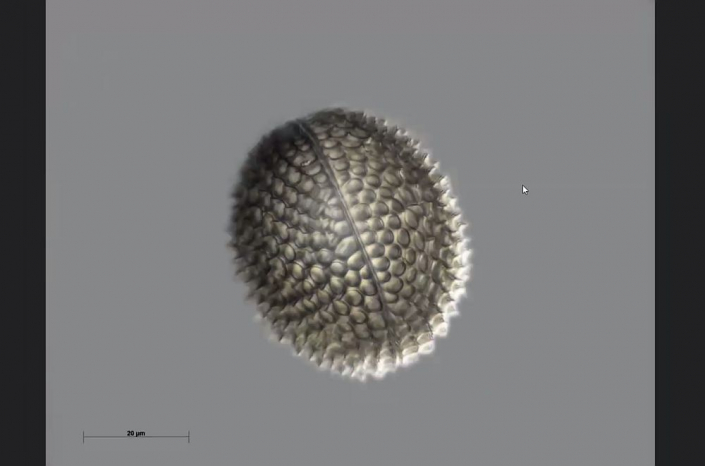 Texas-Diatomeen - vielleicht Stephanpyxsis (Foto Anne Gleich)