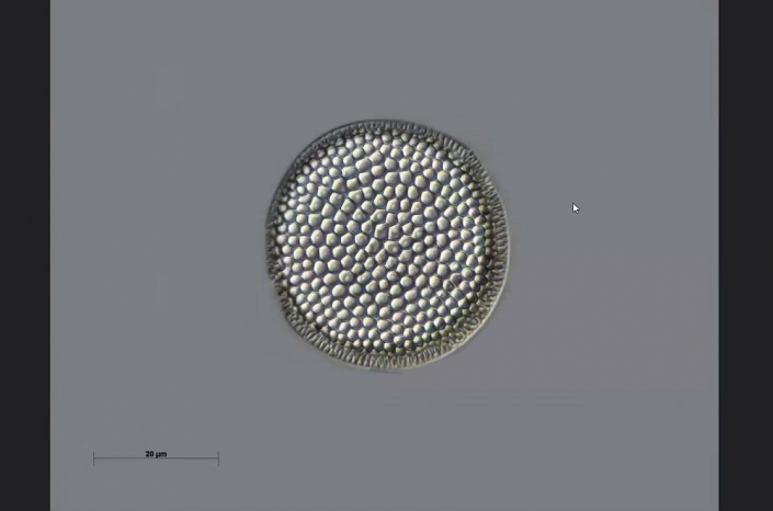 Texas-Diatomeen - vielleicht Thalossiasira (Foto Anne Gleich)