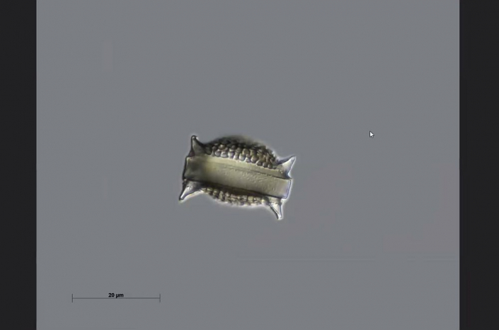 Texas-Diatomeen - Triceratium pantocsekii favus, Gürtelansicht (Foto Anne Gleich)