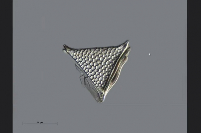 Texas-Diatomeen - Triceratium pantocsekii favus (Foto Anne Gleich)