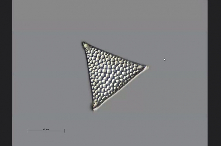 Texas-Diatomeen - Triceratium pantocsekii favus (Foto Anne Gleich)