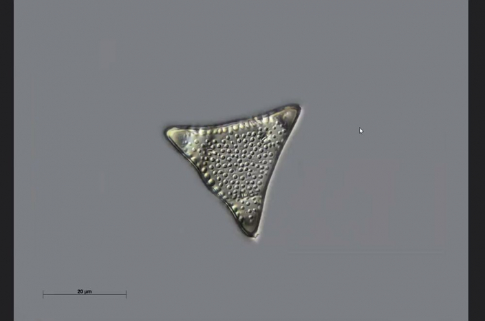 Texas-Diatomeen - Trinacria galea, neue Art (Foto Anne Gleich)