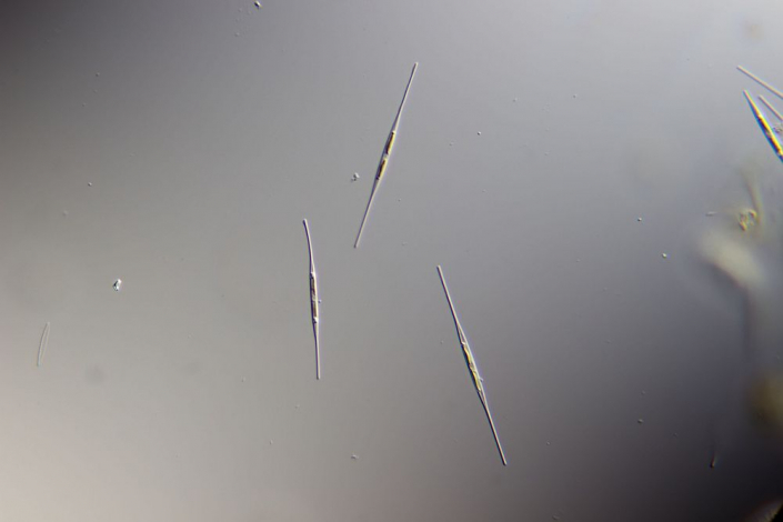 Diatomeen Nitzschia acicularis (Foto Sebastian Kuhn)