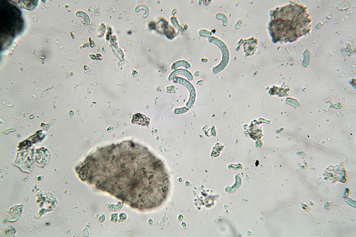 Futtertabletten mit Spirulina (Foto Horst Fries)
