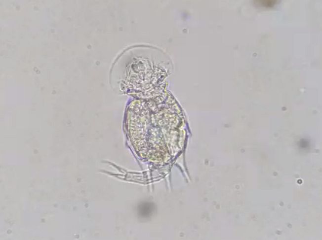 Hauben-Rädertier Squatinella (Foto Nicole Frisch)