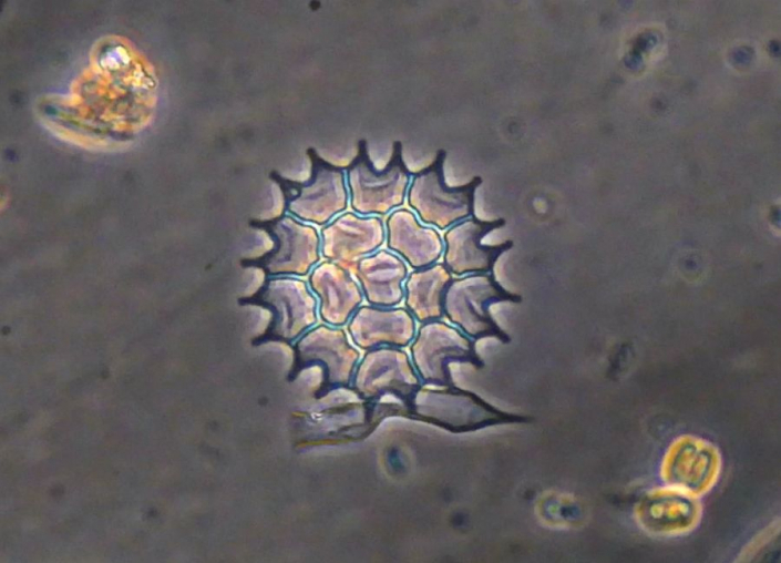 Abgestorbene_Gruenalge_Pediastrum__Foto_Rudolf_Lukes