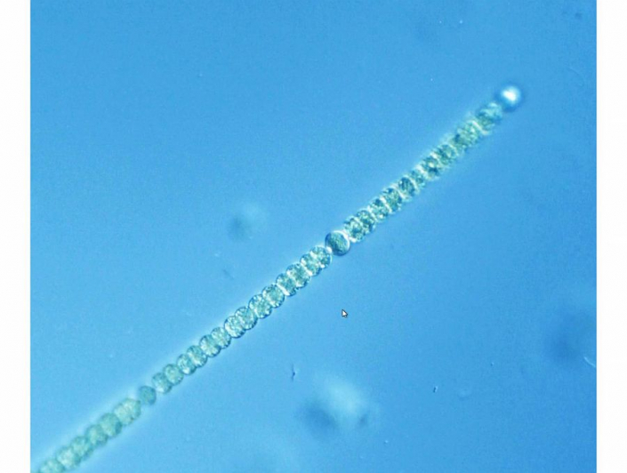 Baggersee_Juli-2026_-_Anabaena__Foto_TMG
