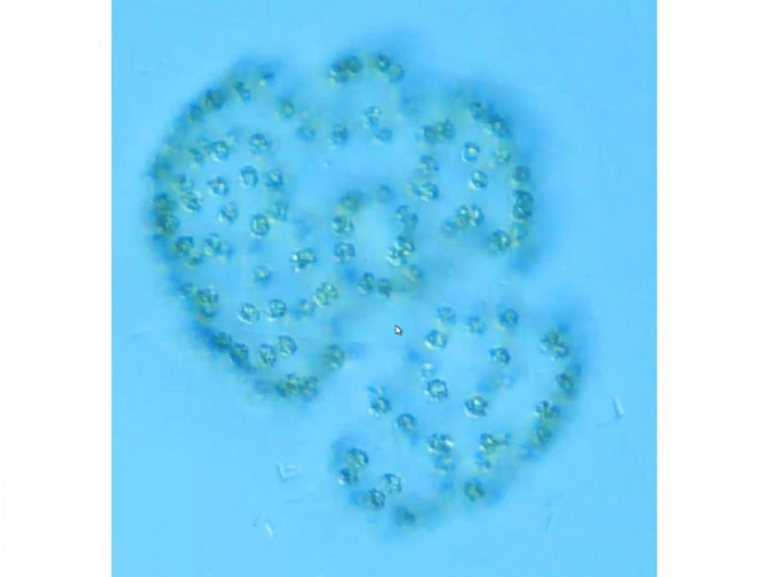 Baggersee_Juli-2026_-_Microcystis__Foto_TMG